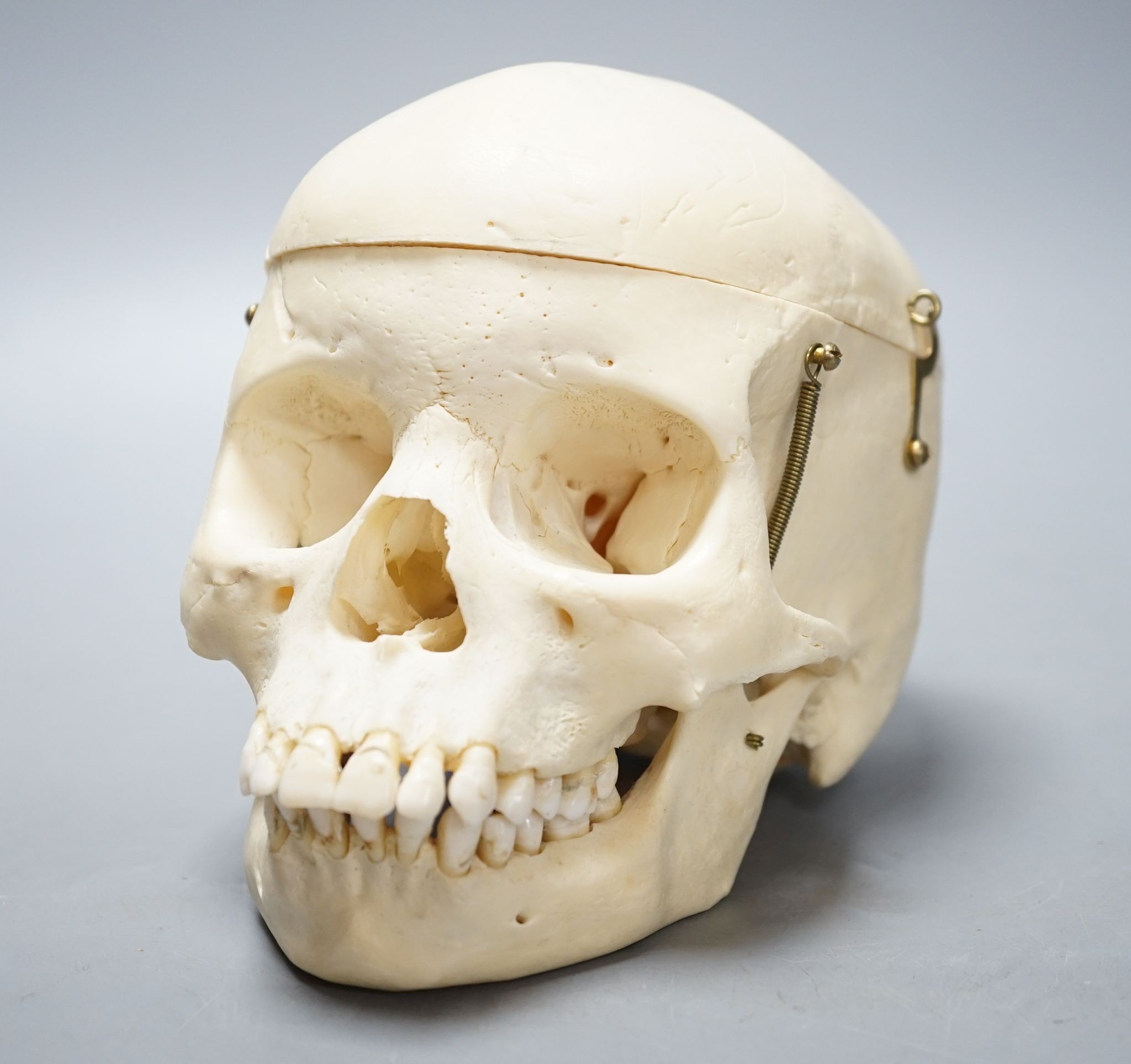 A human skull, acquired c.1976., 14 cms high x 19.5 wide.